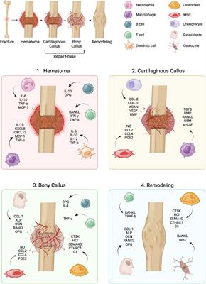 Temporal dynamics of immune-stromal cell interactions in fracture healing